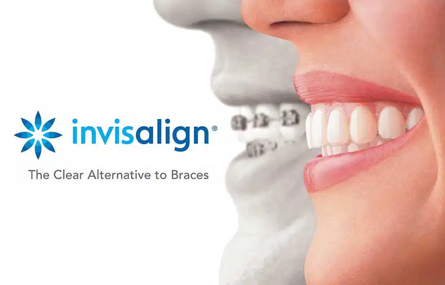 Invisalign Portland Dentist. Clear alternative to braces