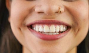 So, does getting Invisalign hurt? The answer, like most things in life, is a bit nuanced. Invisalign, the near-invisible alternative to traditional braces, has become popular for achieving a straighter smile. But let's face it: any orthodontic treatment can conjure images of metal brackets and constant tightening. 